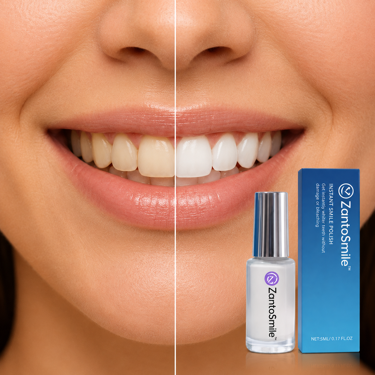 ZantoSmile™ Instant Smile Polish